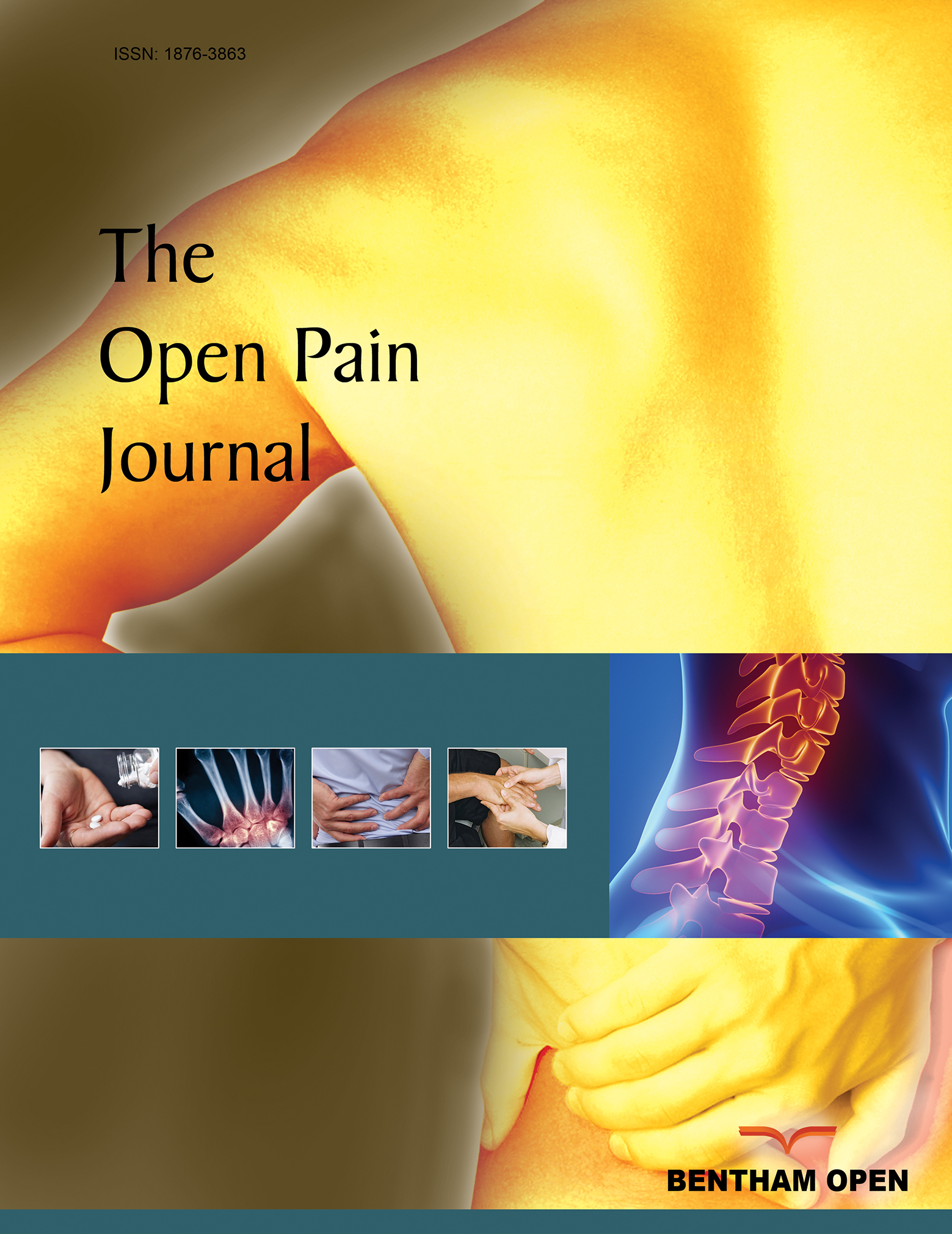 The Open Pain Journal